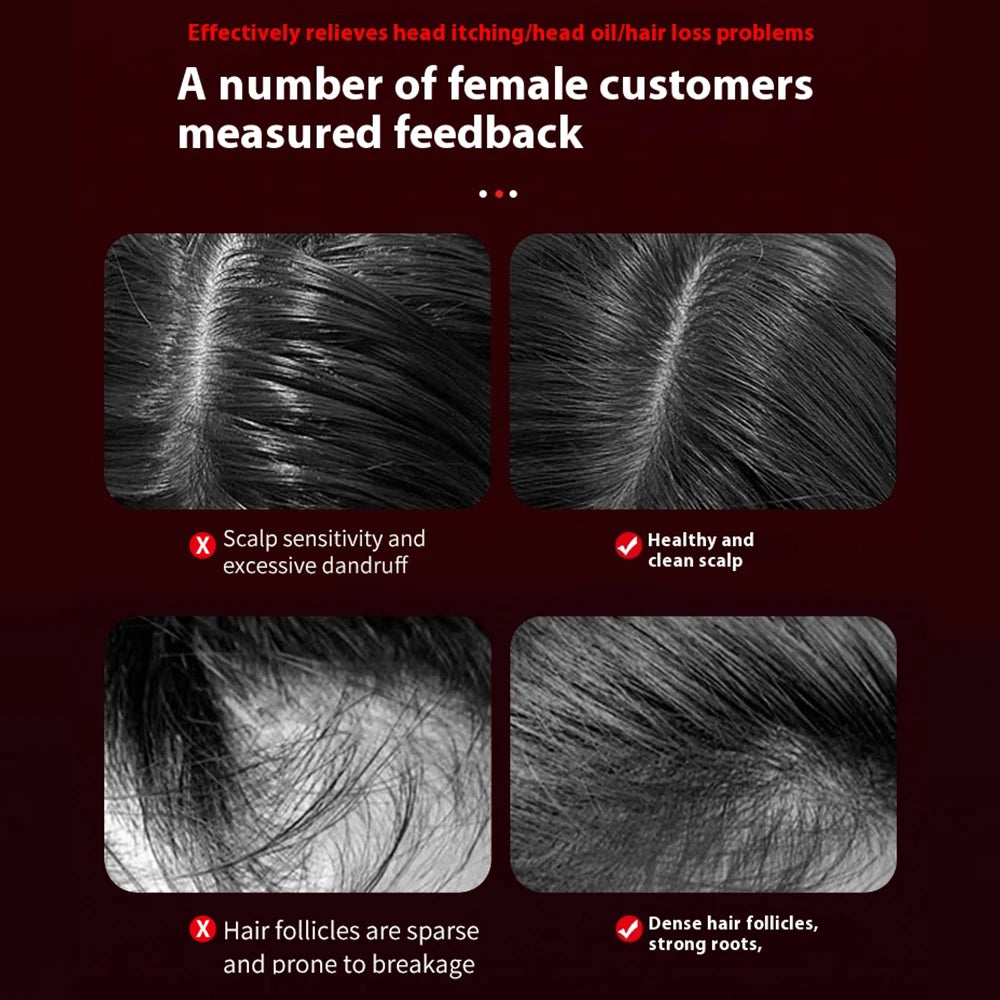 HairHavens™ Scalp Therapy Comb – Electric Massager for Hair Growth