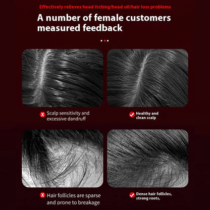 HairHavens™ Scalp Therapy Comb – Electric Massager for Hair Growth